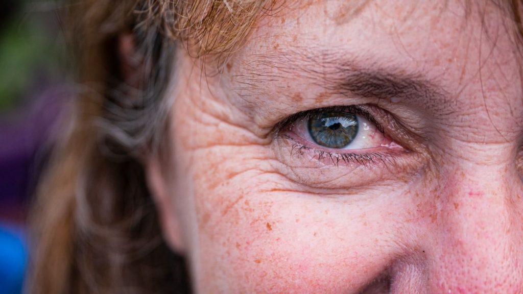 A close up of a persons face with the main focus being the wrinkles